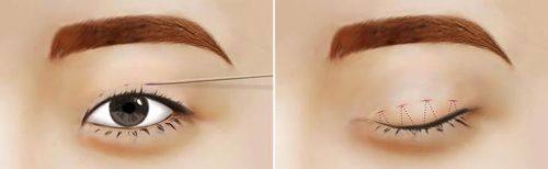 宁波元美医疗美容诊所口碑评价: