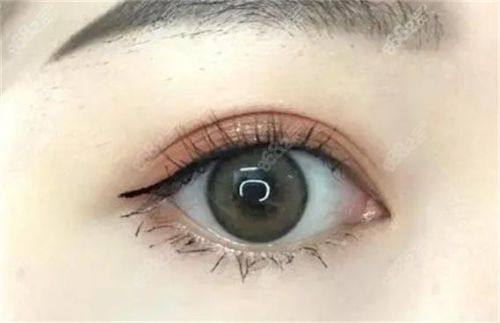 蒋金伟医生怎么预约