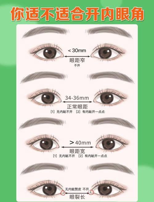 广州维奥医疗整形美容门诊预约挂号方式：