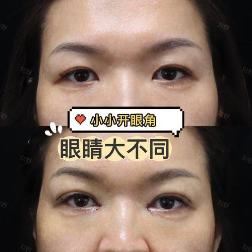 泉州丰泽阳光医疗美容门诊部擅长项目：