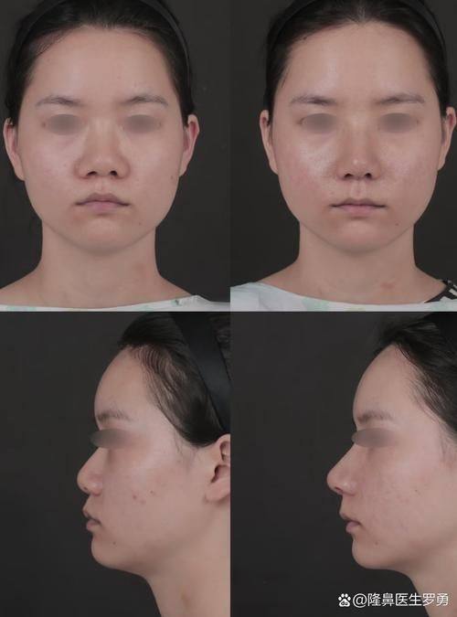 深圳艾妍医疗美容整形口碑评价：