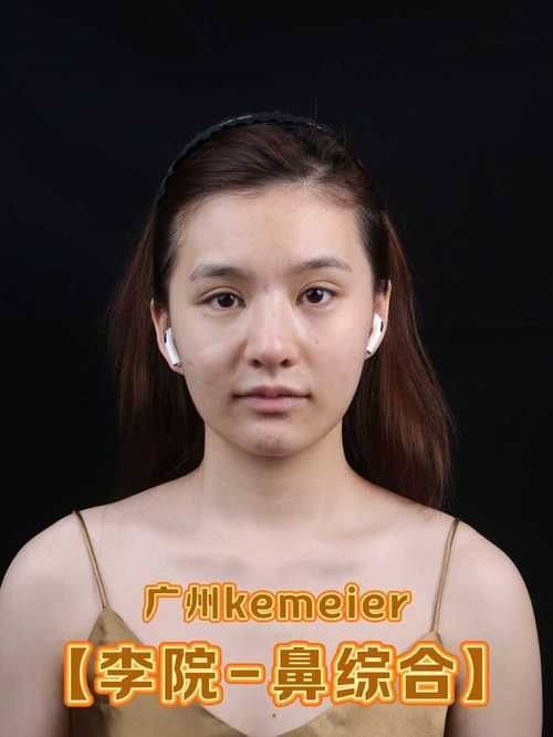 深圳阳光美容整形医院怎么样?