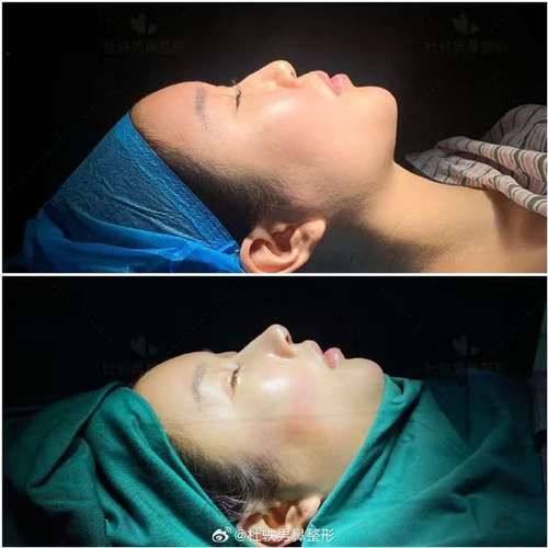 内蒙古包头伽蓝（原巴诺巴奇）医疗美容门诊部口碑评价：