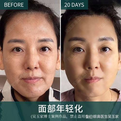 韩国林克link整形外科怎么样?