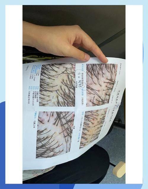 武汉黄陂区中医医院皮肤科价格表: