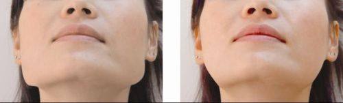 吴昌铉医生擅长领域：