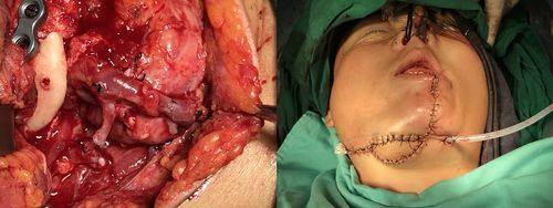 武汉韩辰医学美容医院价格表：