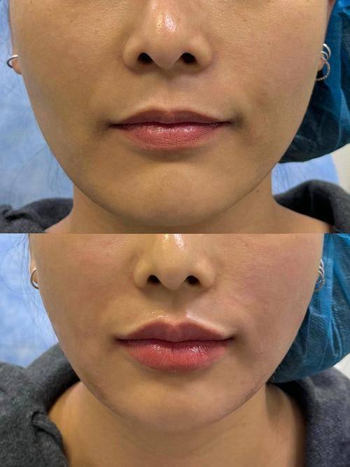 汕头香港肤美堂(祛斑眉眼唇微整形)怎么样？