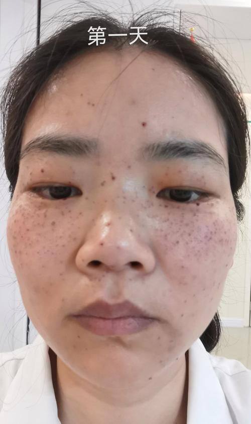 广州维奥医疗整形美容门诊口碑评价：