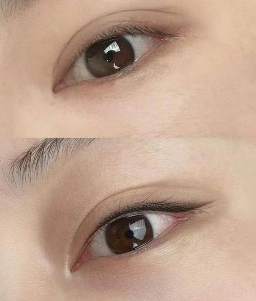 汕头香港肤美堂(祛斑眉眼唇微整形)价格表：