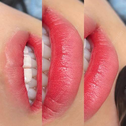 汕头香港肤美堂(祛斑眉眼唇微整形)预约挂号方式：