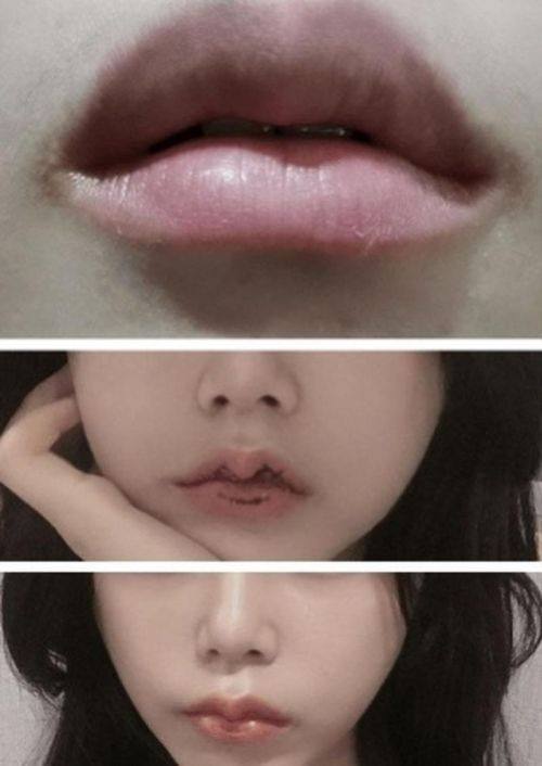 焦作俪人医疗美容诊所价格表: