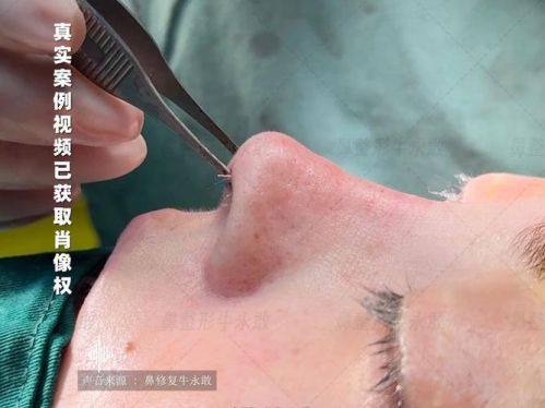 深圳阳光美容整形医院地址电话及营业时间