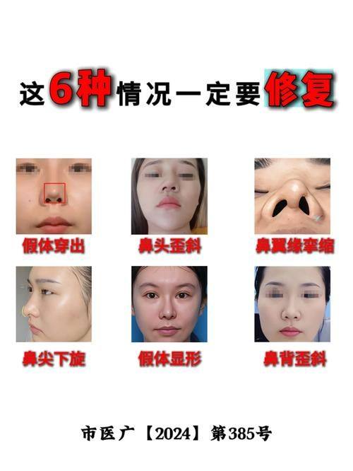 深圳天丽医疗美容医院地址电话及营业时间: