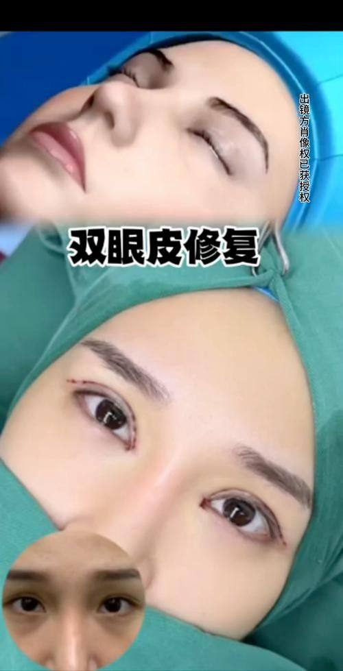 深圳阳光美容整形医院医生名单及擅长领域: