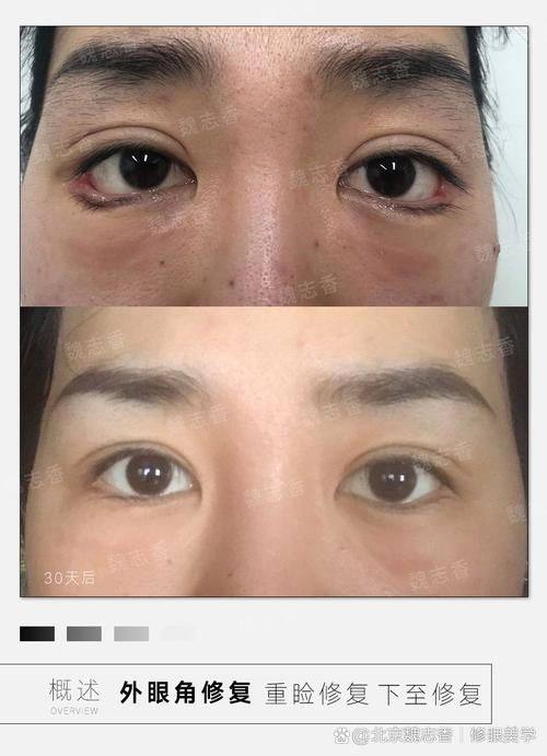 深圳阳光美容整形医院口碑评价