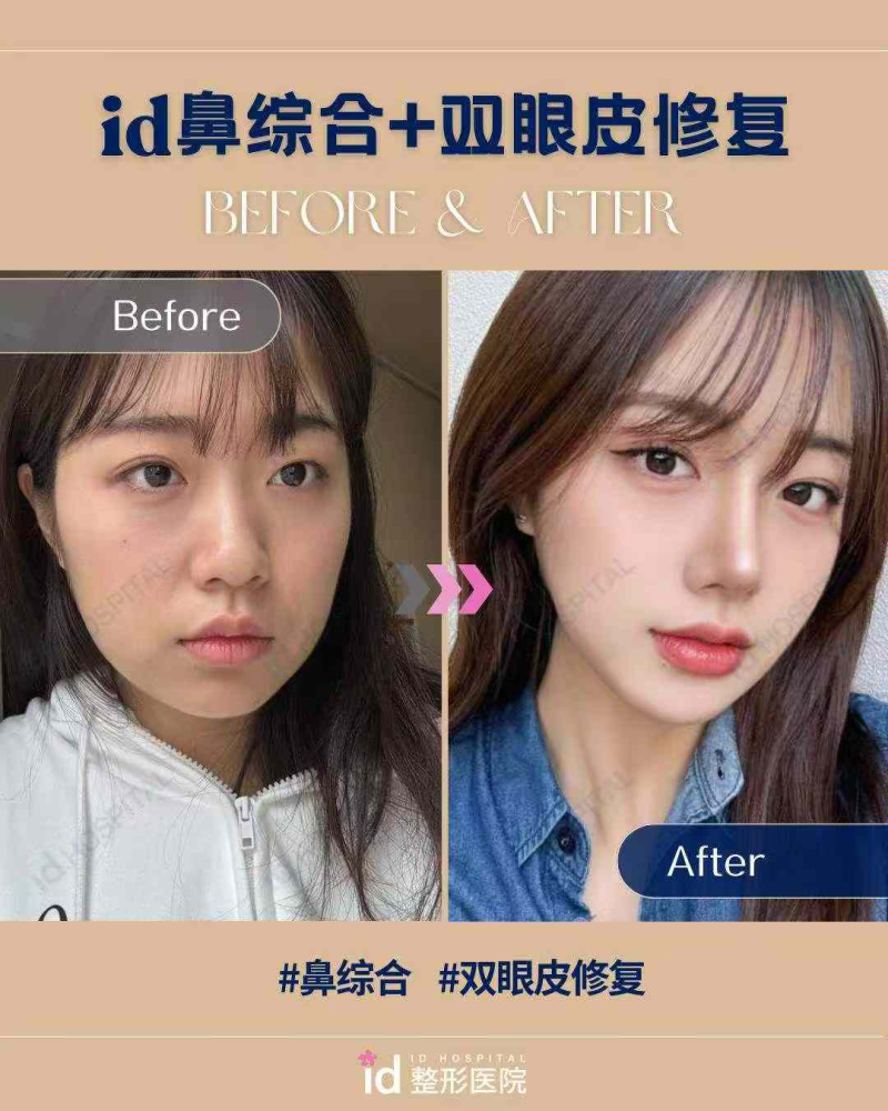 深圳天丽医疗美容医院怎么样?