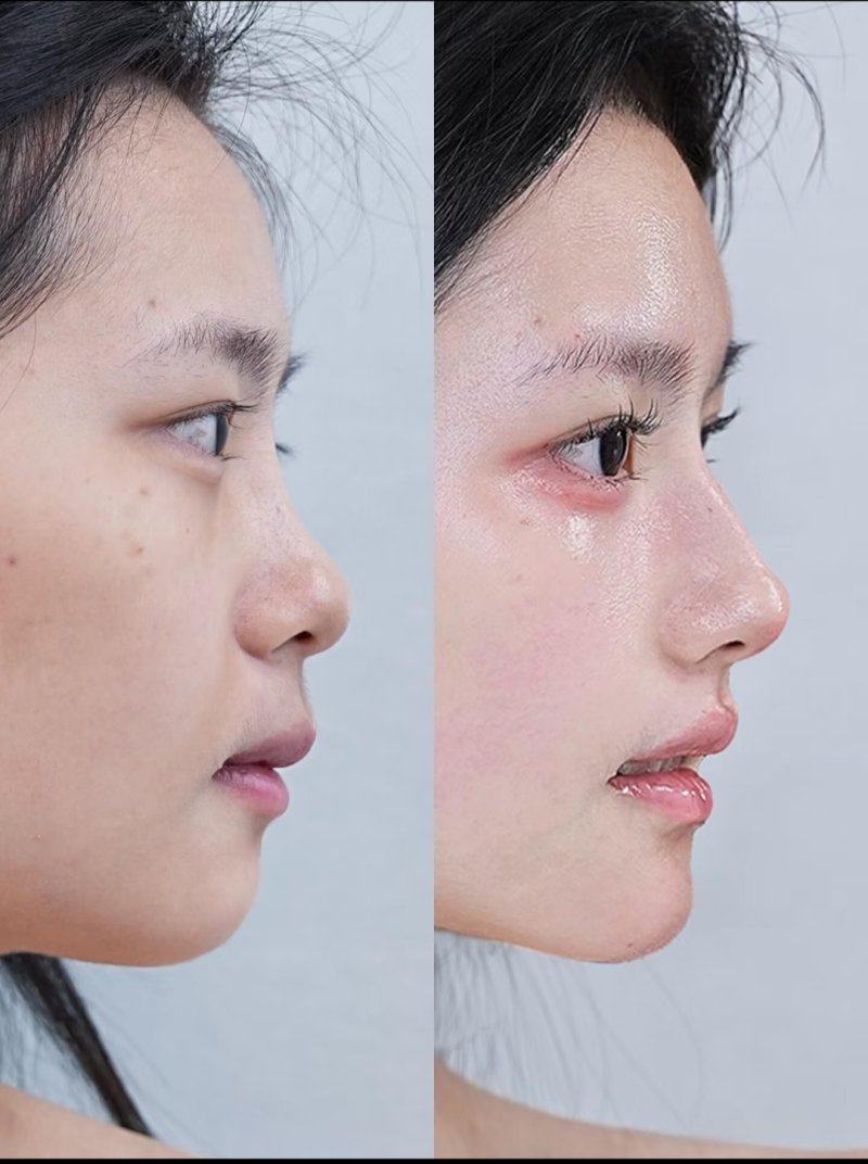 吴昌铉医生技术优势：