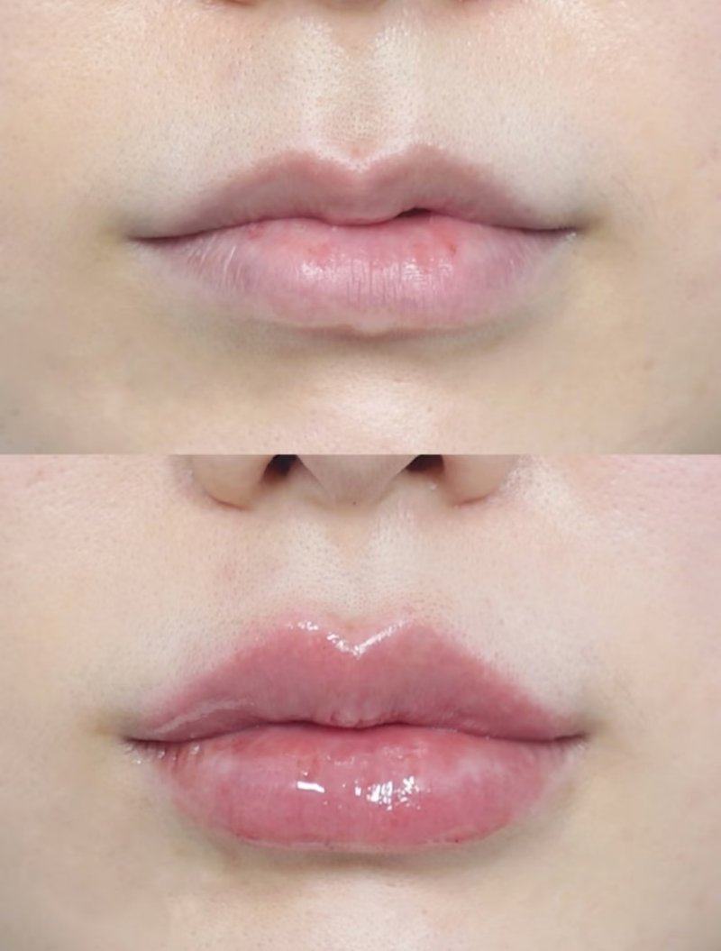 四、药物治疗:辅助改善的关键选项