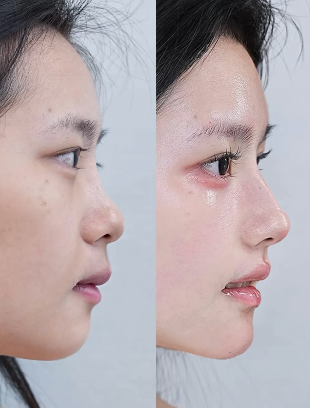 三、手术治疗:需联合方案规避高复发