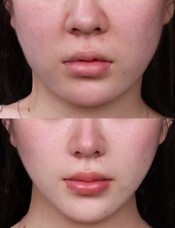 唐山恩瑜整形医院预约挂号方式