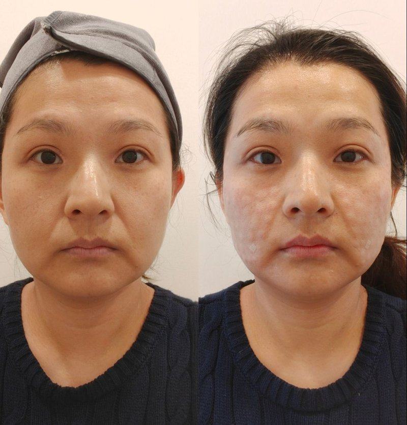 吴昌铉医生怎么预约？