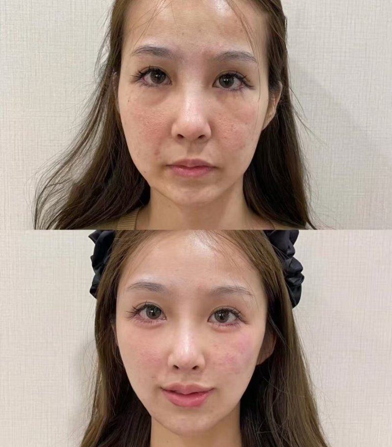 广州维奥医疗整形美容门诊价格表：