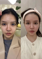 三、修复费用是否免费？