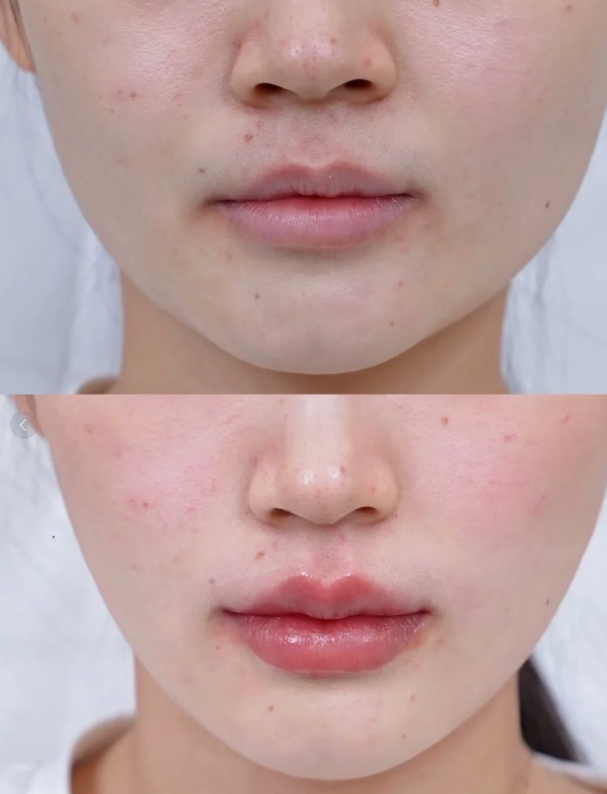 五、“内双眼皮”的核心含义是什么?