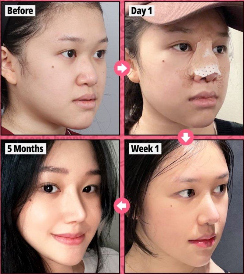 深圳艾妍医疗美容整形怎么样？