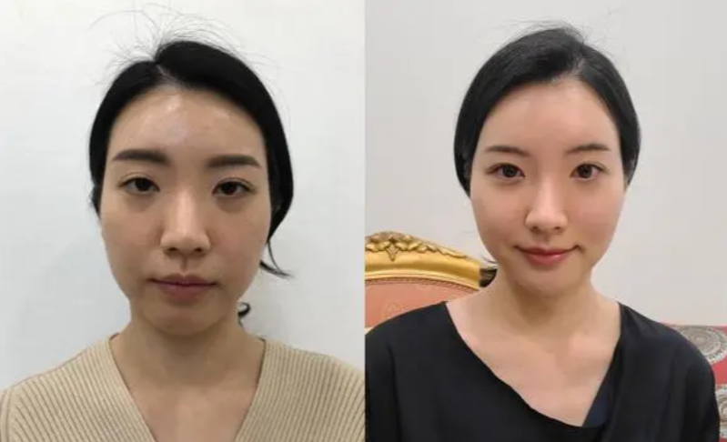 五、激光与传统方法:按需选择的补充手段