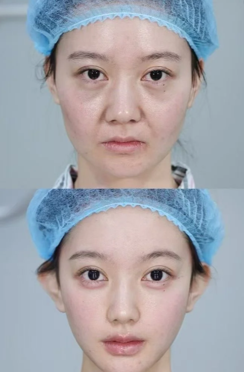 唐山恩瑜整形医院擅长项目