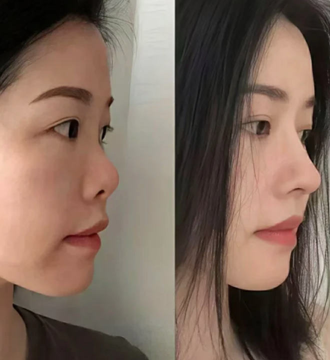 韩国林克link整形外科医生名单及擅长领域: