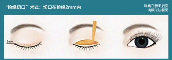 黄振银医生技术优势