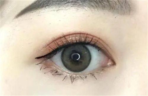 武汉一美整形美容门诊部擅长项目：