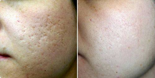 那里割双眼皮比较好？国内外多城优质医院合集，技术成熟效果自然不踩坑