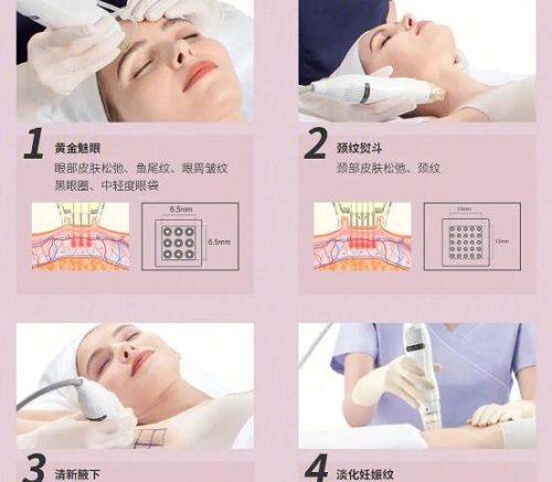 四、韩国粉毒瘦脸针在国内合规吗?