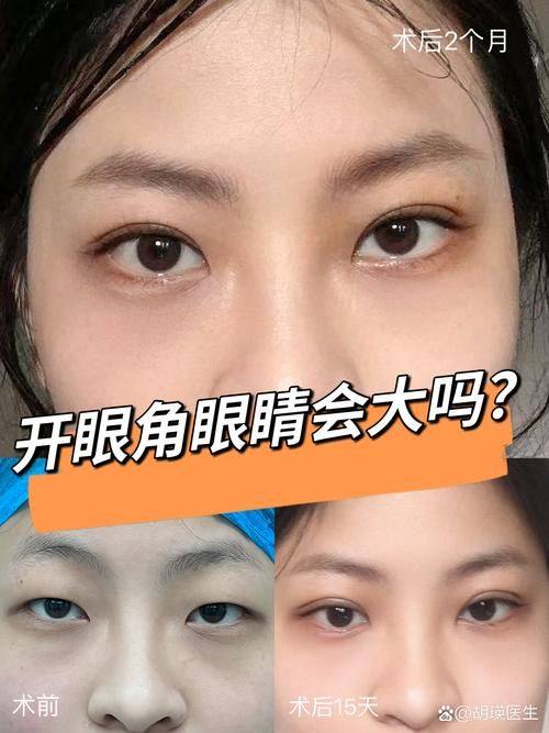 成河旻医生怎么预约