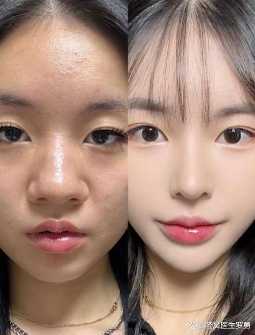 新疆王共礼整形伊宁分院价格表：