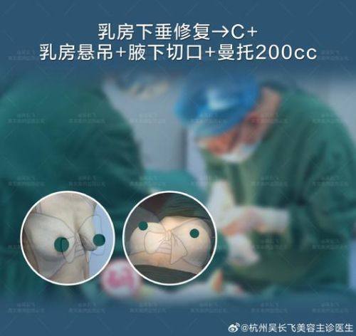 淮安唯尔美整形怎么样？