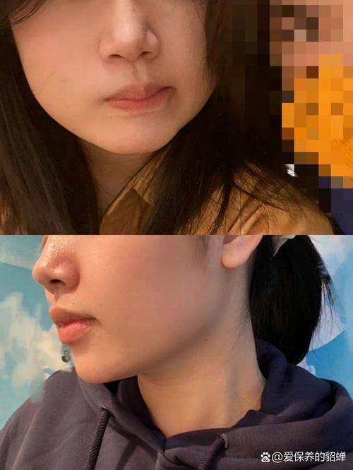 北京紫竹整形医疗美容门诊医生名单及擅长领域: