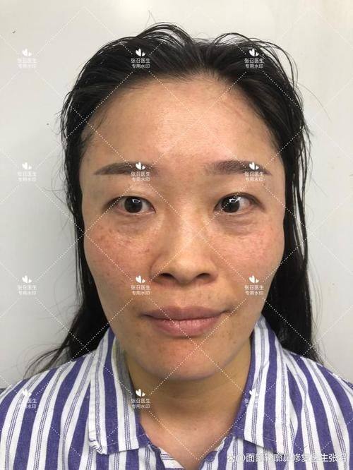 大连和颜一美恒乔整形医院怎么样？