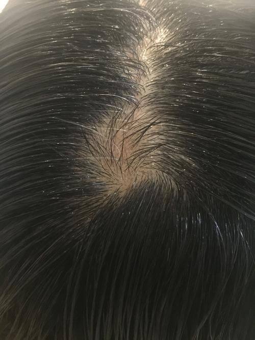 李惠芹医生怎么预约