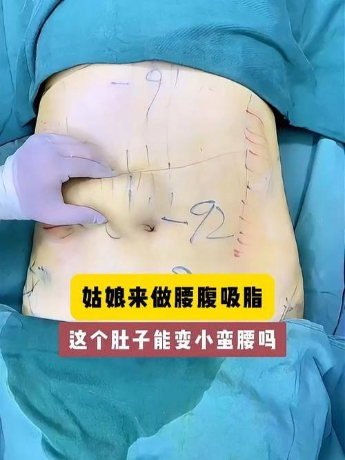 郑州风韵都市整形美容医院口碑评价