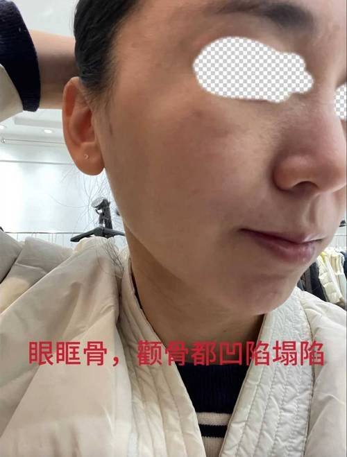 南京柠檬医疗美容诊所口碑评价: