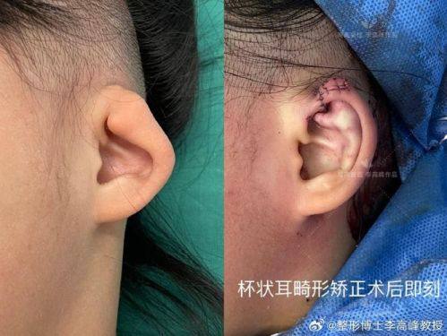 贵阳泰康乐医院整形外科价格表：