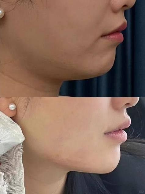 方培耀医生擅长领域