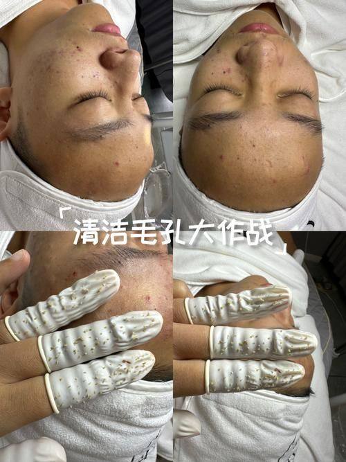 刘林全医生擅长领域