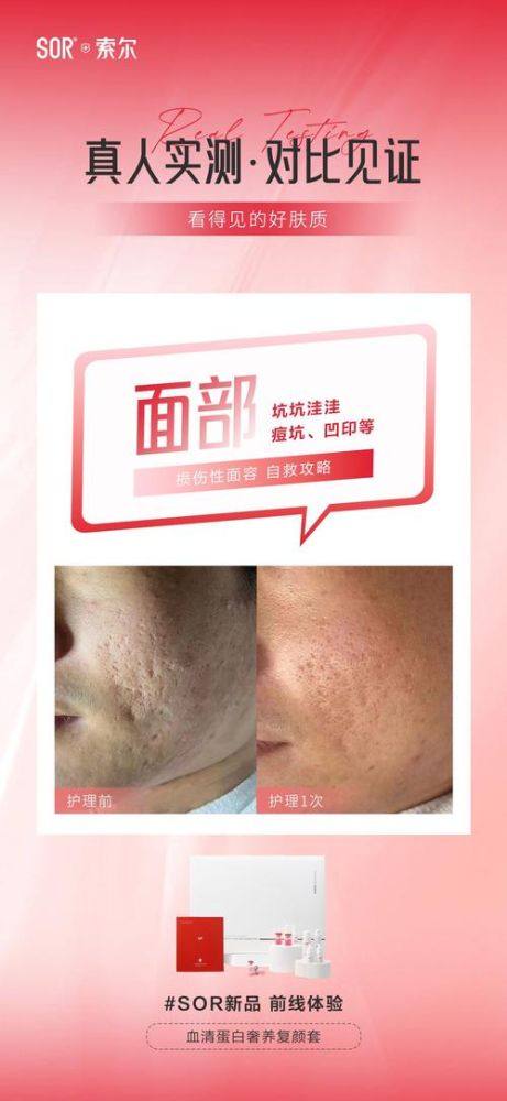 淮安唯尔美整形擅长项目：