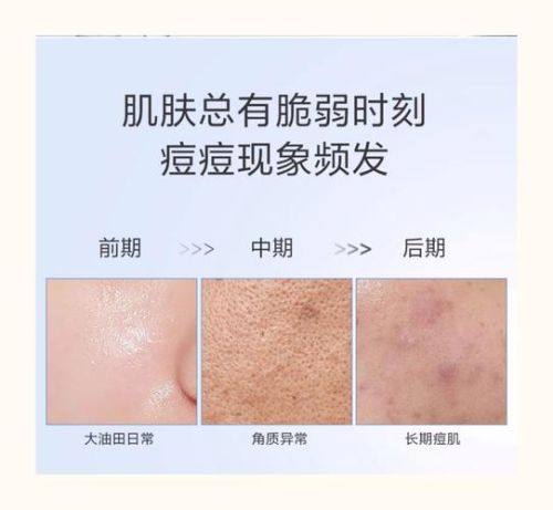 温州芬迪医美整形擅长项目